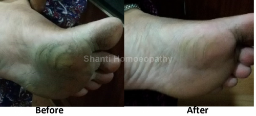 Shanti-Homoeopathic-Hospital-18